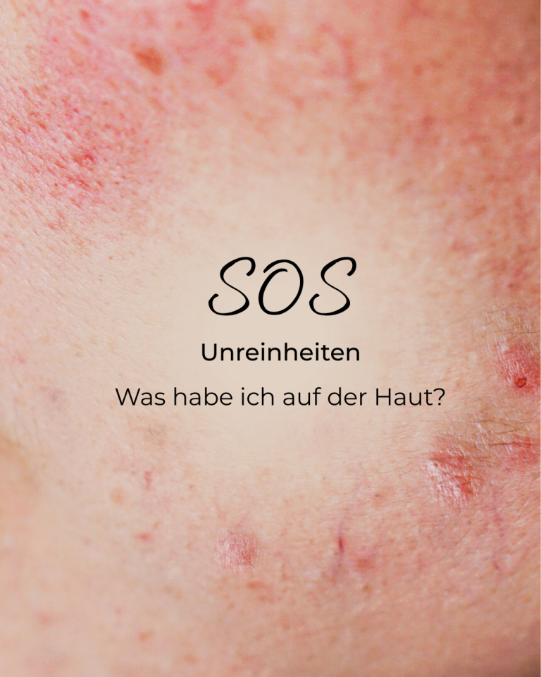 akne behandeln dortmund