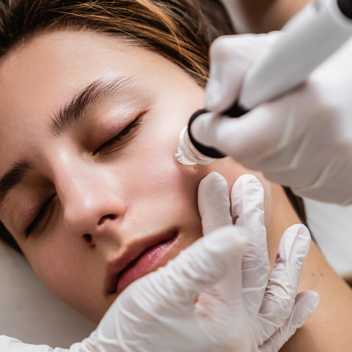Aqua Facial im Kosmetikstudio Dortmund Aqua Facial Hydrafacial für eine professionelle Gesichtsreinigung im Kosmetikstudio Dortmund