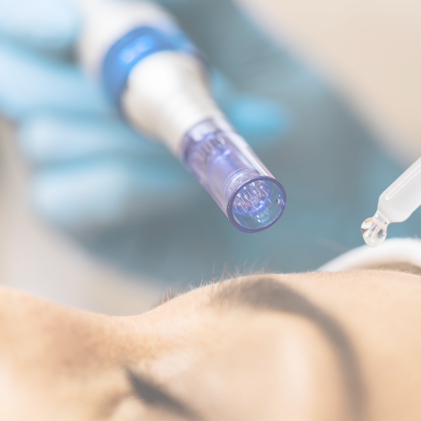 Anti Aging Kosmetik Dortmund Professionelles Microneedling im Kosmetikstudio Dortmund